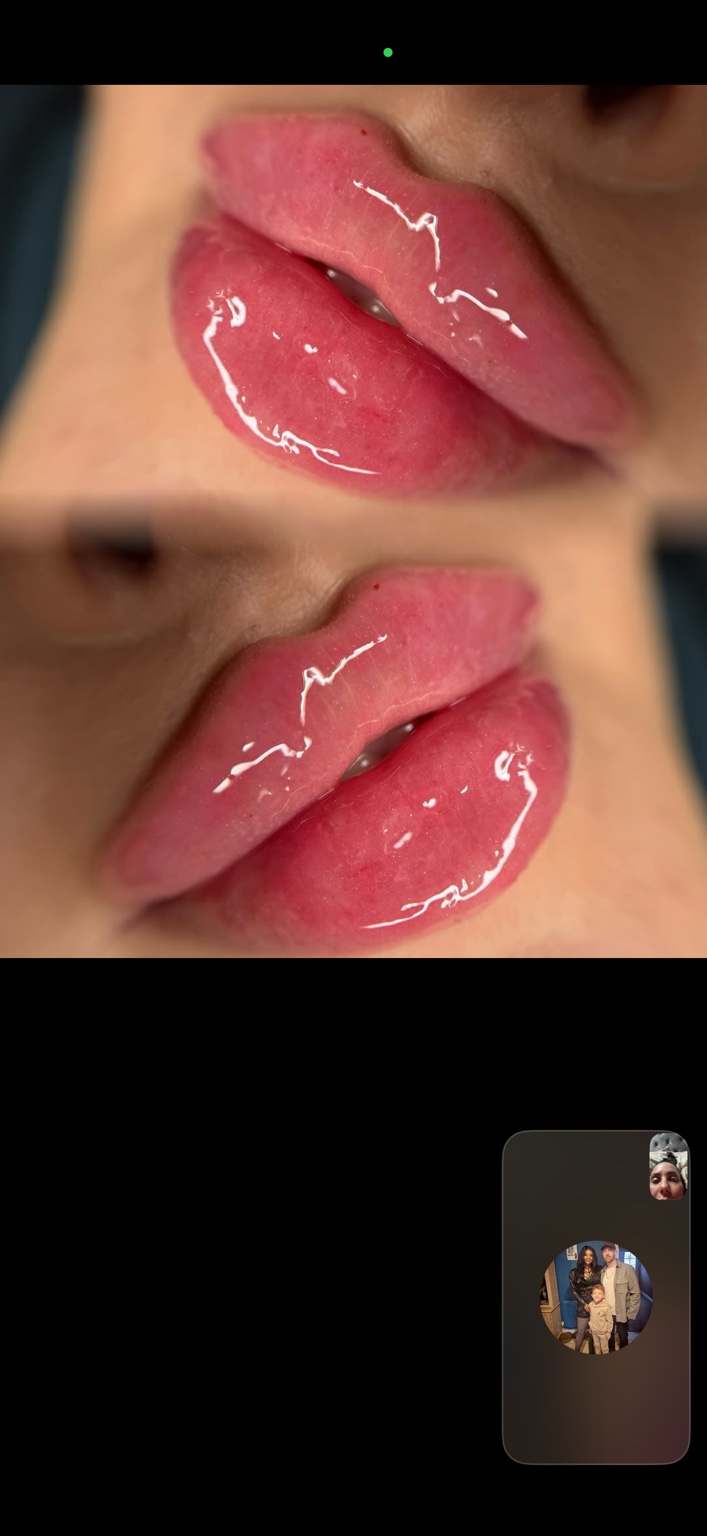 Two close-up views of lips